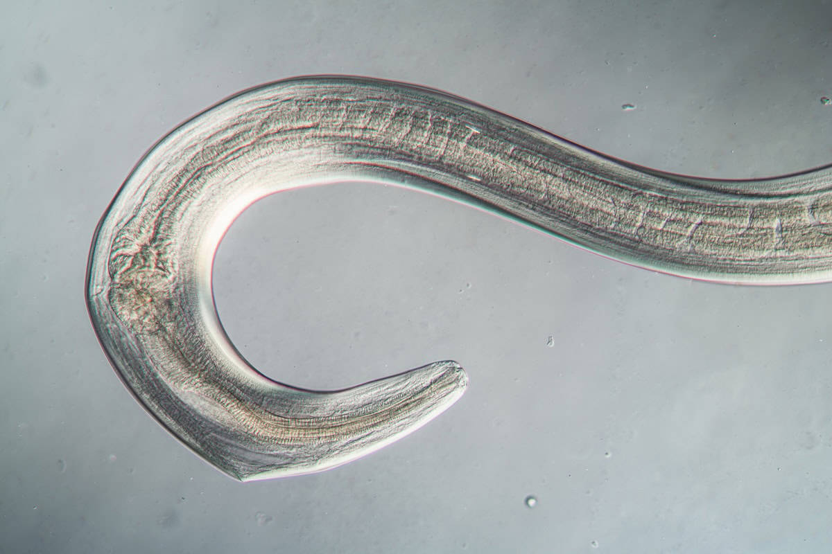 Worms as a model for personalized medicine